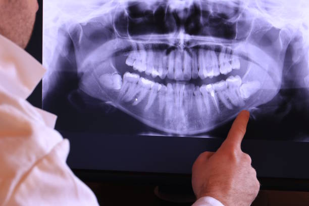 Best Mobile Emergency Dentist in Centreville, MI