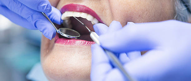 Best Broken or Cracked Tooth Emergency Dentist in Centreville, MI